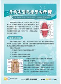 口腔科挂图  口腔挂图 牙的类型及根管治疗