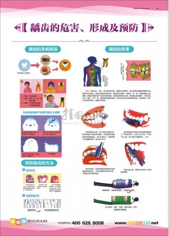 口腔科挂图龋齿的危害形成及预防