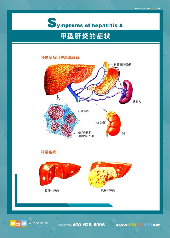 肝脏解剖图 肝病科解剖图-甲型肝炎的症状