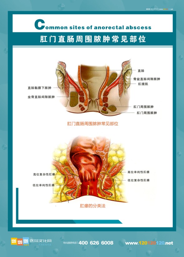 肛肠科解剖图-肛门直肠周围脓肿常见部位