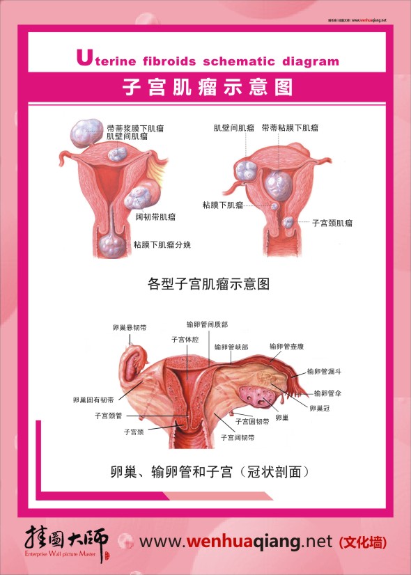 人体结构解剖图   人体结构图   人体结构示意图   子宫肌瘤示意图     