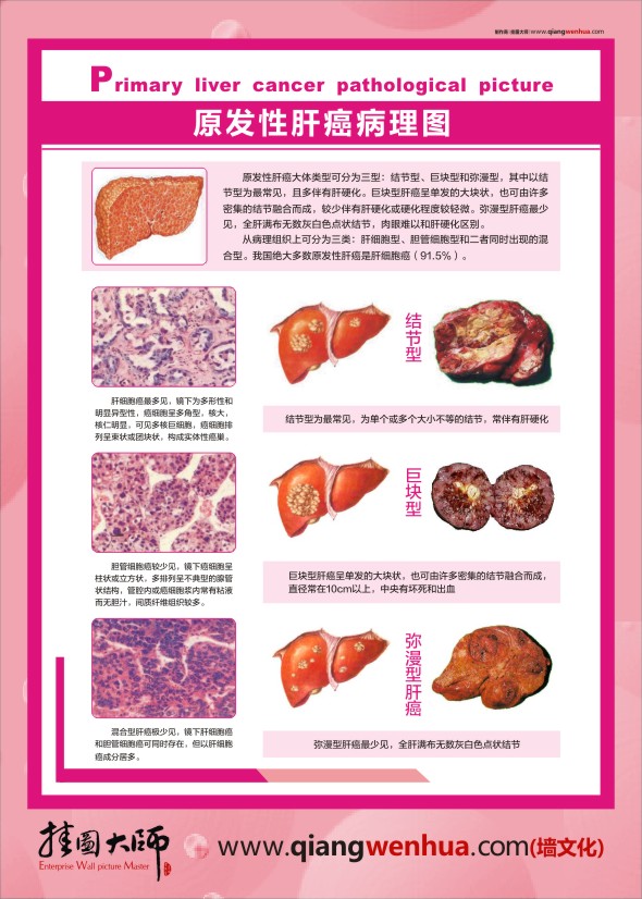 人体肝脏结构 人体肝脏解剖图谱